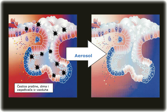 Aerosol - uticaj soli na organizam